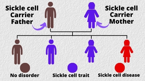 Condition of Sickle Cell Anemia in Hindi
